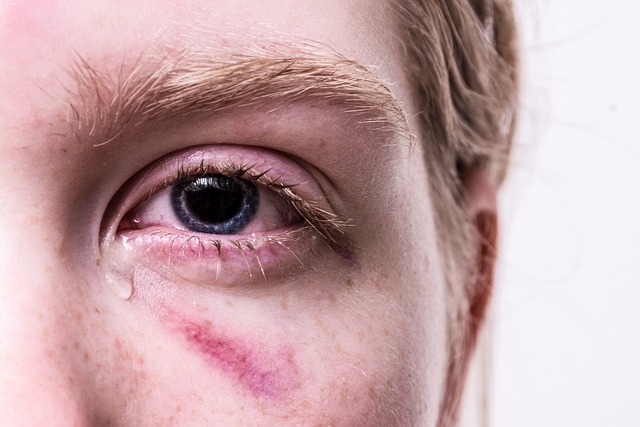 7 Stages of Trauma Bonding, Not Love
